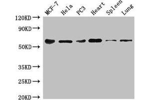 Western Blot Positive WB detected in: MCF-7 whole cell lysate, Hela whole cell lysate, PC-3 whole cell lysate, Mouse heart tissue, Mouse spleen tissue, Mouse lung tissue All lanes: TROVE2 antibody at 3 μg/mL Secondary Goat polyclonal to rabbit IgG at 1/50000 dilution Predicted band size: 61, 24, 59, 60 kDa Observed band size: 61 kDa (TROVE2 Antikörper  (AA 3-535))