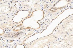 Immunohistochemistry analysis of paraffin-embedded human kidney using,MTND1 (ABIN7074658) at dilution of 1: 1000 (MT-ND1 Antikörper)