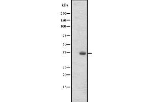 Western blot analysis of OR2T27 expression in 293 cell line lysates ,The lane on the left is treated with the antigen-specific peptide. (OR2T27 Antikörper  (Internal Region))