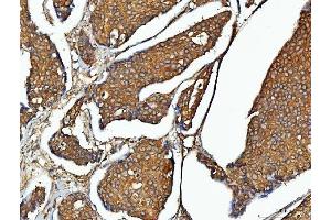 IHC analysis of EEF2 using anti-EEF2 antibody (ABIN7599561).