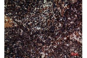 Immunohistochemistry (IHC) image for anti-Integrin alpha 4 (ITGA4) (Internal Region) antibody (ABIN3187778)