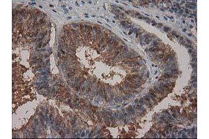 Immunohistochemistry (IHC) image for anti-Hydroxyprostaglandin Dehydrogenase 15-(NAD) (HPGD) antibody (ABIN1496362) (HPGD Antikörper)