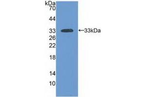 Detection of Recombinant LAMa3, Human using Polyclonal Antibody to Laminin Alpha 3 (LAMa3) (LAMA3 Antikörper  (AA 47-296))