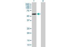 Western Blot analysis of GPI expression in transfected 293T cell line by GPI MaxPab polyclonal antibody. (GPI Antikörper  (AA 1-558))