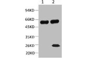 1) Input: Mouse Brain Tissue Lysate 2) IP product: IP dilute 1: 200 Western blot analysis: primary antibody : 1: 10000 Secondary antibody: Goat anti-Mouse IgG, Light chain specific (S003), 1: 5000 (TUBB2A Antikörper)