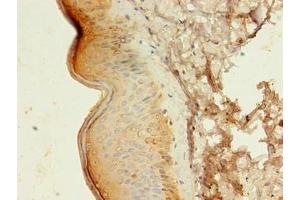 Immunohistochemistry of paraffin-embedded human skin tissue using ABIN7145104 at dilution of 1:100 (ATG16L1 Antikörper  (AA 1-607))