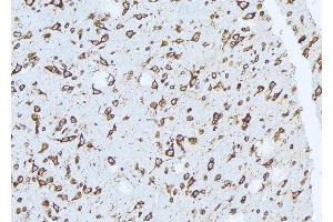 ABIN6272459 at 1/100 staining Mouse brain tissue by IHC-P. (ATP6V1H Antikörper  (Internal Region))