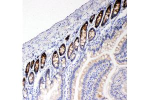 Anti-NKCC1 antibody, IHC(P) IHC(P): Rat Intestine Tissue