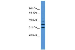 WB Suggested Anti-GIMAP6 Antibody Titration: 0. (GIMAP6 Antikörper  (C-Term))