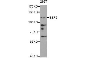 Western blot analysis of extracts of 293T cells, using EEF2 antibody. (EEF2 Antikörper)