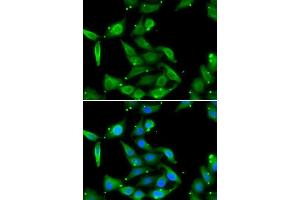 Immunofluorescence analysis of U2OS cells using GAMT antibody. (GAMT Antikörper  (AA 1-236))