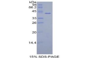 SDS-PAGE (SDS) image for Histone H2A Type 1-H (HIST1H2AH) (AA 1-128) protein (His tag,GST tag) (ABIN1821797)