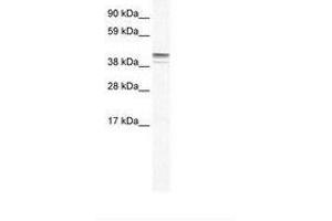Image no. 1 for anti-Zinc Finger Protein 627 (ZNF627) (AA 44-93) antibody (ABIN6735960) (ZNF627 Antikörper  (AA 44-93))
