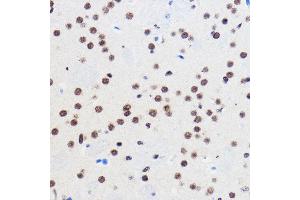 Immunohistochemistry of paraffin-embedded Mouse brain using GTF3C3 Rabbit pAb (ABIN7267374) at dilution of 1:100 (40x lens).