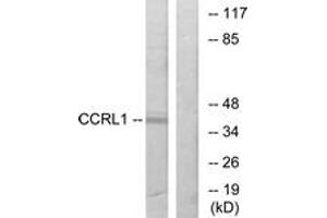 Western blot analysis of extracts from 293 cells, using CCRL1 Antibody.