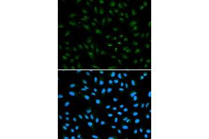 Immunofluorescence analysis of A549 cell using AR antibody. (Androgen Receptor Antikörper)