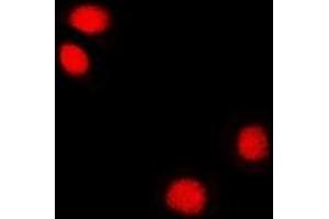 Immunofluorescent analysis of Reptin 52 staining in U2OS cells. (RUVBL2 Antikörper)