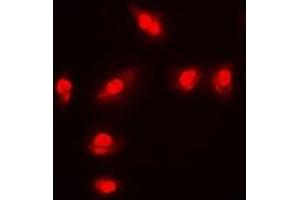 Immunofluorescent analysis of FOXO1 (pS256) staining in MCF7 cells. (FOXO1 Antikörper  (pSer256))