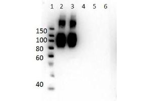 Western Blot of Mouse Anti-Hemoglobin A (beta chain) Antibody. (Hemoglobin Subunit beta Antikörper  (N-Term))