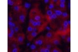 Immunofluorescence (IF) image for anti-Ubiquitin (Ub) antibody (ABIN7250323)