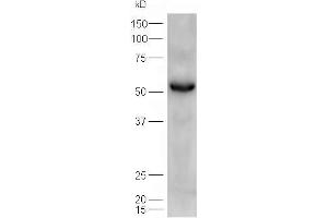 Lane 1: mouse heart  probed with Rabbit Anti-ATGL/Adipose Triglyceride Lipase Polyclonal Antibody, Unconjugated (ABIN704756) at 1:300 overnight at 4 °C. (PNPLA2 Antikörper  (AA 401-504))