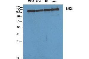 Western Blot (WB) analysis of specific cells using BM28 Polyclonal Antibody. (MCM2 Antikörper  (N-Term))