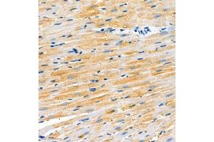 Immunohistochemistry of paraffin embedded rat heart using SCN4b (ABIN7075646) at dilution of 1:2000 (300x lens)