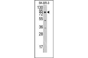 Image no. 1 for anti-Discoidin Domain Receptor tyrosine Kinase 1 (DDR1) antibody (ABIN359899) (DDR1 Antikörper)