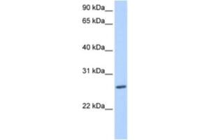 Western Blotting (WB) image for anti-Zinc Finger Protein 664 (ZNF664) antibody (ABIN2463457) (ZNF664 Antikörper)