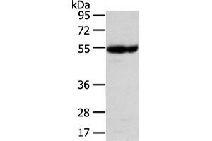 Western Blotting (WB) image for anti-Ubiquitin Associated Protein 1 (UBAP1) antibody (ABIN5961309) (UBAP1 Antikörper)