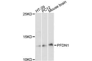 Western blot analysis of extracts of various cell lines, using PFDN1 antibody (ABIN5996513) at 1:3000 dilution. (PFDN1 Antikörper)