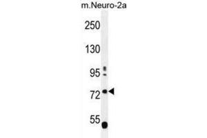 Western Blotting (WB) image for anti-Leucine-Rich Repeat and WD Repeat-Containing Protein 1 (LRWD1) antibody (ABIN2996388)