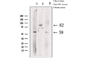 Western blot analysis of extracts from various samples, using Phospho-HSF1 (Ser303) Antibody. (HSF1 Antikörper  (pSer303))