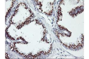 Image no. 1 for anti-Golgi Membrane Protein 1 (GOLM1) antibody (ABIN1498497) (GOLM1 Antikörper)