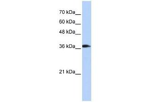ATP6V0D2 antibody used at 1 ug/ml to detect target protein. (ATP6V0D2 Antikörper  (Middle Region))
