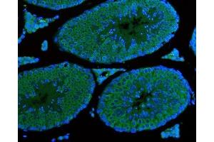 IF analysis of DDX4/MVH using anti-DDX4/MVH antibody (ABIN7601204).
