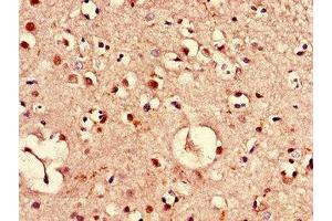 Immunohistochemistry of paraffin-embedded human brain tissue using ABIN7169149 at dilution of 1:100 (PIM3 Antikörper  (AA 278-326))