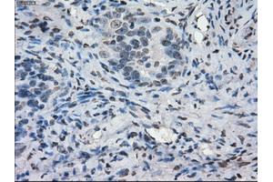 Immunohistochemical staining of paraffin-embedded colon tissue using anti-PORmouse monoclonal antibody. (POR Antikörper)