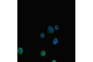 Immunofluorescent analysis of MCF-7 cells using ABIN7144657 at dilution of 1:100 and Alexa Fluor 488-congugated AffiniPure Goat Anti-Rabbit IgG(H+L) (Aryl Hydrocarbon Receptor Antikörper  (AA 126-353))