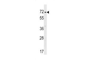 ZN Antibody (C-term) (ABIN1537388 and ABIN2848620) western blot analysis in HepG2 cell line lysates (35 μg/lane). (ZNF155 Antikörper  (C-Term))