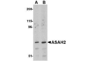 Western blot analysis of ASAH2 in 293 cell lysate with AP30083PU-N ASAH2 antibody at (A) 1 and (B) 2 μg/ml. (ASAH2 Antikörper  (C-Term))