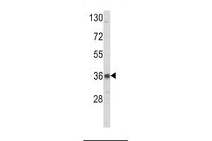 Western blot analysis of LDLR Antibody (N-term) (ABIN392553 and ABIN2842100) in K562 cell line lysates (35 μg/lane). (LDLRAP1 Antikörper  (N-Term))