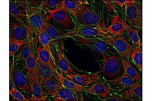 Immunocytochemistry staining of Sos in murine transformed fibroblasts using anti-Sos (SOS-01, red). (Sos Antikörper)