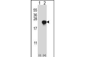 Western blot analysis of ARL2 (arrow) using rabbit polyclonal ARL2 Antibody  (ABIN650704 and ABIN2839229). (ARL2 Antikörper  (C-Term))