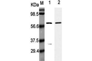 Western Blot analysis using anti-Listeria monocytogenes, mAb (P6007)  at 1:5000 dilution. (Listeria Monocytogenes, P60 Antikörper)