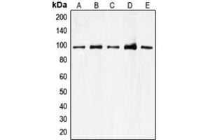 Western blot analysis of CDC27 expression in A549 (A), K562 (B), Jurkat (C), HEK293T (D), HeLa (E) whole cell lysates. (CDC27 Antikörper  (Center))