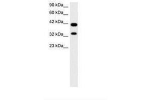 Image no. 2 for anti-Paired Box Gene 2a (PAX2A) (AA 174-223) antibody (ABIN202997) (PAX2A Antikörper  (AA 174-223))