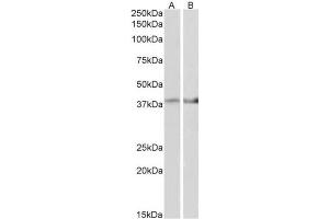 AP31421PU-N IDH3B antibody staining of Mouse Heart (A) and Mouse Muscle (B) lysate at 2 µg/ml (35µg protein in RIPA buffer). (IDH3B Antikörper  (AA 33-46))