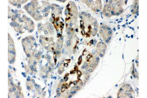 Anti- PAX6 Picoband antibody, IHC(P) IHC(P): Human Pancreatic Cancer Tissue (PAX6 Antikörper  (Middle Region))