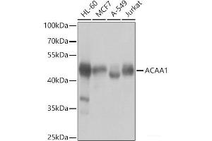 Western blot analysis of extracts of various cell lines using ACAA1 Polyclonal Antibody at dilution of 1:1000. (ACAA1 Antikörper)